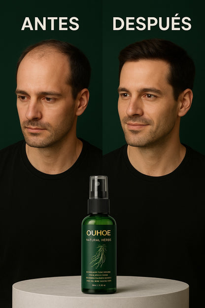 OUHOE -CRECIMIENTO DE CABELLO